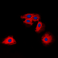 CLDN6 / Claudin 6 Antibody - Immunofluorescent analysis of Claudin 6 staining in HUVEC cells. Formalin-fixed cells were permeabilized with 0.1% Triton X-100 in TBS for 5-10 minutes and blocked with 3% BSA-PBS for 30 minutes at room temperature. Cells were probed with the primary antibody in 3% BSA-PBS and incubated overnight at 4 C in a humidified chamber. Cells were washed with PBST and incubated with a DyLight 594-conjugated secondary antibody (red) in PBS at room temperature in the dark. DAPI was used to stain the cell nuclei (blue).