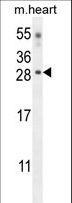 CLDN6 / Claudin 6 Antibody - CLDN6 Antibody western blot of mouse heart tissue lysates (35 ug/lane). The CLDN6 antibody detected the CLDN6 protein (arrow).
