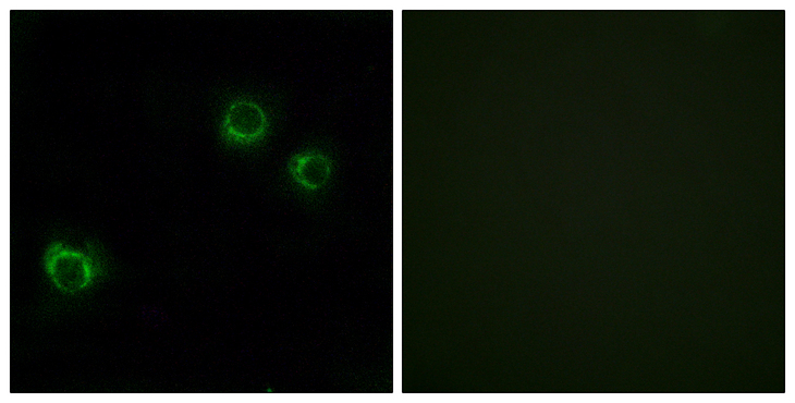 CLDN6 / Claudin 6 Antibody - Immunofluorescence analysis of HUVEC cells, using CLDN6 Antibody. The picture on the right is blocked with the synthesized peptide.