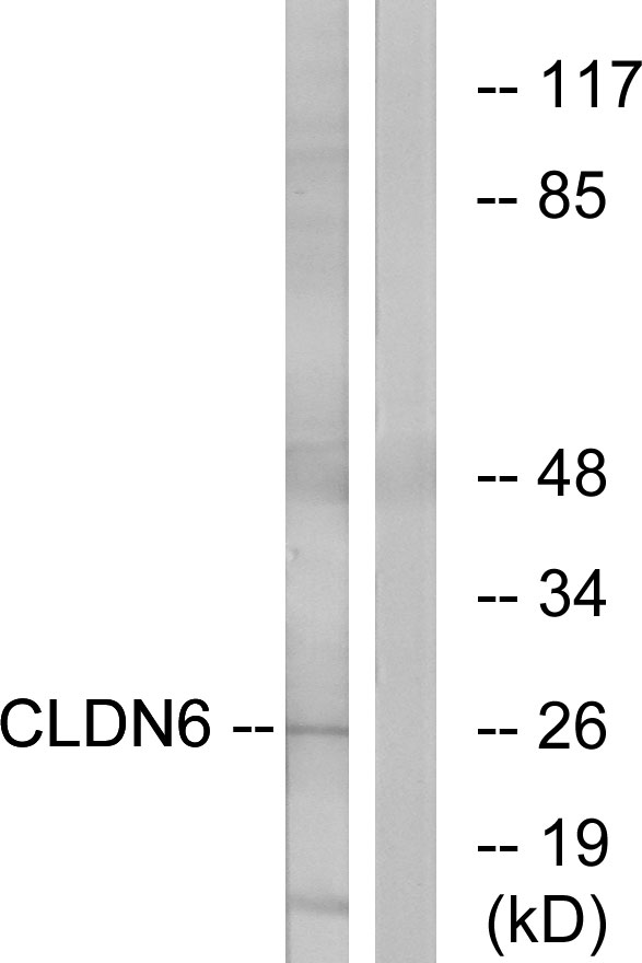 CLDN6 / Claudin 6 Antibody - Western blot analysis of lysates from Jurkat cells, using CLDN6 Antibody. The lane on the right is blocked with the synthesized peptide.