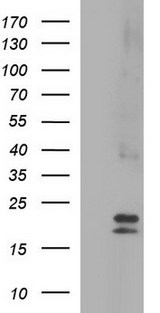 CLDN6 / Claudin 6 Antibody - HEK293T cells were transfected with the pCMV6-ENTRY control (Left lane) or pCMV6-ENTRY CLDN6 (Right lane) cDNA for 48 hrs and lysed. Equivalent amounts of cell lysates (5 ug per lane) were separated by SDS-PAGE and immunoblotted with anti-CLDN6.