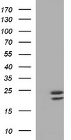 CLDN6 / Claudin 6 Antibody - HEK293T cells were transfected with the pCMV6-ENTRY control (Left lane) or pCMV6-ENTRY CLDN6 (Right lane) cDNA for 48 hrs and lysed. Equivalent amounts of cell lysates (5 ug per lane) were separated by SDS-PAGE and immunoblotted with anti-CLDN6.