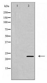 CLDN6 / Claudin 6 Antibody - Western blot of CLDN6 expression in Jurkat cells