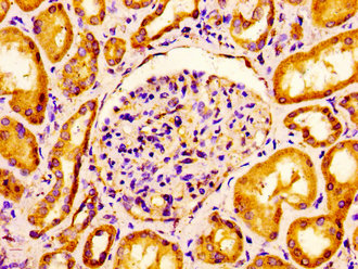 CLDN6 / Claudin 6 Antibody - Immunohistochemistry image of paraffin-embedded human kidney tissue at a dilution of 1:100