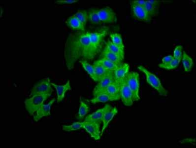 CLDN6 / Claudin 6 Antibody - Immunofluorescence staining of HepG2 cells with CLDN6 Antibody at 1:133, counter-stained with DAPI. The cells were fixed in 4% formaldehyde, permeabilized using 0.2% Triton X-100 and blocked in 10% normal Goat Serum. The cells were then incubated with the antibody overnight at 4°C. The secondary antibody was Alexa Fluor 488-congugated AffiniPure Goat Anti-Rabbit IgG(H+L).