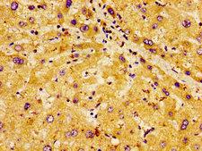 CLDN6 / Claudin 6 Antibody - Immunohistochemistry image of paraffin-embedded human liver tissue at a dilution of 1:100