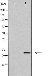 CLDN6 / Claudin 6 Antibody - Western blot analysis of CLDN6 expression in Jurkat cells. The lane on the left is treated with the antigen-specific peptide.