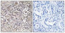 CLDN6 / Claudin 6 Antibody - Peptide - + Immunohistochemistry analysis of paraffin-embedded human ovary tissue using CLDN6 antibody.
