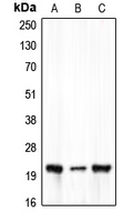 CLDN7 / Claudin 7 Antibody - Western blot analysis of Claudin 7 expression in HEK293T (A); Raw264.7 (B); rat heart (C) whole cell lysates.