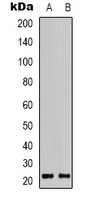 CLDN7 / Claudin 7 Antibody - Western blot analysis of Claudin 7 expression in COLO205 (A); rat liver (B) whole cell lysates.