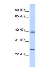 CLDN7 / Claudin 7 Antibody - Hela cell lysate. Antibody concentration: 1.0 ug/ml. Gel concentration: 12%.  This image was taken for the unconjugated form of this product. Other forms have not been tested.