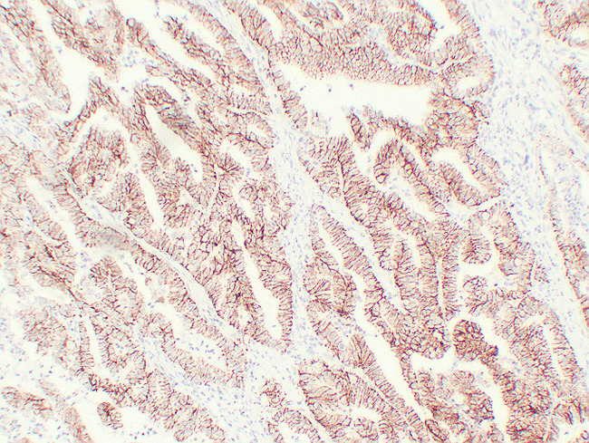 CLDN7 / Claudin 7 Antibody - Colon Carcinoma 1