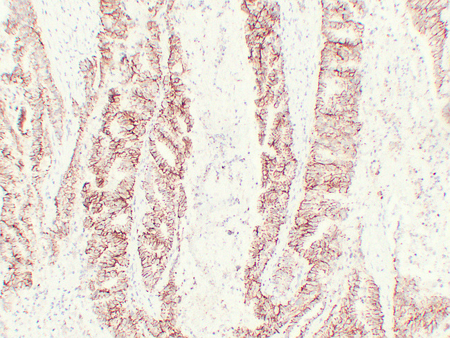 CLDN7 / Claudin 7 Antibody - Colon Carcinoma 2