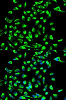 CLDN7 / Claudin 7 Antibody - Immunofluorescence analysis of MCF-7 cells.