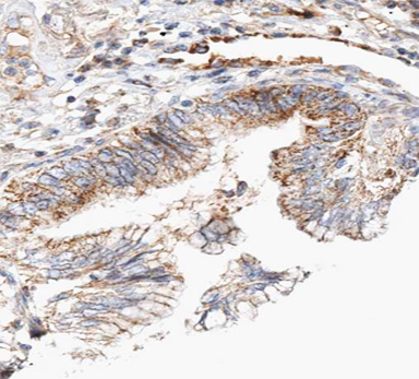 CLDN7 / Claudin 7 Antibody - 1:100 staining human lung tissue by IHC-P. The tissue was formaldehyde fixed and a heat mediated antigen retrieval step in citrate buffer was performed. The tissue was then blocked and incubated with the antibody for 1.5 hours at 22°C. An HRP conjugated goat anti-rabbit antibody was used as the secondary.