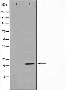 CLDN7 / Claudin 7 Antibody - Western blot analysis on rat liver tissue cell lysates using Claudin 7 antibody. The lane on the left is treated with the antigen-specific peptide.