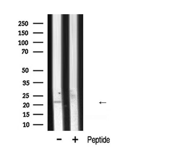 CLDN7 / Claudin 7 Antibody - Western blot analysis of CLDN7 expression in mouse Heart lysate