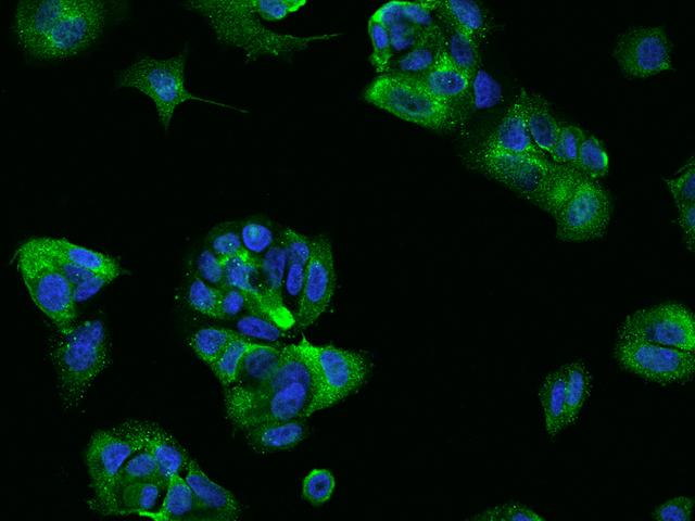 CLDN7 / Claudin 7 Antibody - Immunofluorescence staining of CLDN7 in MCF7 cells. Cells were fixed with 4% PFA, blocked with 10% serum, and incubated with rabbit anti-Human CLDN7 polyclonal antibody (dilution ratio 1:200) at 4°C overnight. Then cells were stained with the Alexa Fluor 488-conjugated Goat Anti-rabbit IgG secondary antibody (green) and counterstained with DAPI (blue). Positive staining was localized to Cytoplasm.
