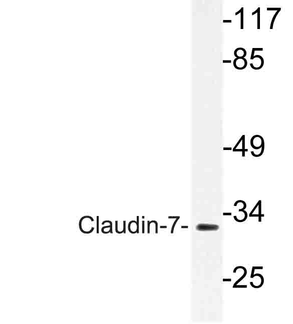 CLDN7 / Claudin 7 Antibody - Western blot of VDR (K45) pAb in extracts from rat liver cells.