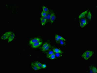 CLDN8 / Claudin 8 Antibody - Immunofluorescent analysis of HepG2 cells using CLDN8 Antibody at dilution of 1:100 and Alexa Fluor 488-congugated AffiniPure Goat Anti-Rabbit IgG(H+L)