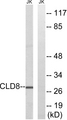 CLDN8 / Claudin 8 Antibody - Western blot analysis of lysates from Jurkat cells, using CLDN8 Antibody. The lane on the right is blocked with the synthesized peptide.