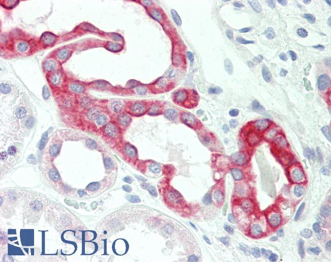 CLDN8 / Claudin 8 Antibody - Anti-CLDN8 / Claudin 8 antibody IHC staining of human kidney. Immunohistochemistry of formalin-fixed, paraffin-embedded tissue after heat-induced antigen retrieval.  This image was taken for the unconjugated form of this product. Other forms have not been tested.