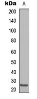 CLDN8 / Claudin 8 Antibody - Western blot analysis of Claudin 8 expression in HepG2 (A) whole cell lysates.