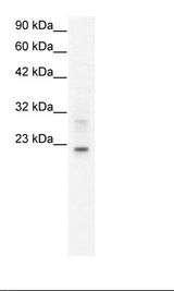 CLDN9 / Claudin 9 Antibody - HepG2 Cell Lysate.  This image was taken for the unconjugated form of this product. Other forms have not been tested.
