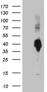 CLEC10A / CD301 Antibody - HEK293T cells were transfected with the pCMV6-ENTRY control. (Left lane) or pCMV6-ENTRY CLEC10A. (Right lane) cDNA for 48 hrs and lysed