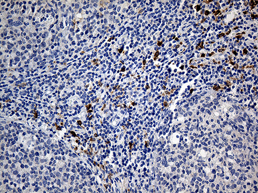 CLEC10A / CD301 Antibody - Immunohistochemical staining of paraffin-embedded Human tonsil within the normal limits using anti-CLEC10A mouse monoclonal antibody. (Heat-induced epitope retrieval by 1mM EDTA in 10mM Tris buffer. (pH8.5) at 120°C for 3 min. (1:500)