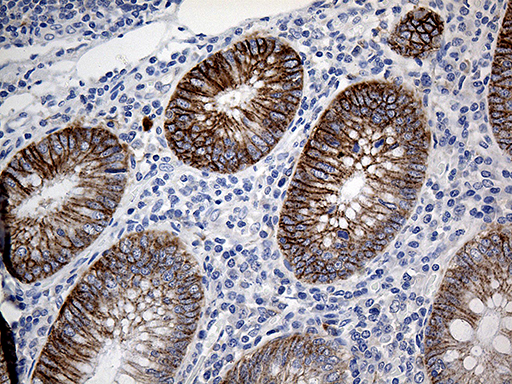 CLEC10A / CD301 Antibody - Immunohistochemical staining of paraffin-embedded Human appendix tissue within the normal limits using anti-CLEC10A mouse monoclonal antibody. (Heat-induced epitope retrieval by 1mM EDTA in 10mM Tris buffer. (pH8.5) at 120°C for 3 min. (1:500)
