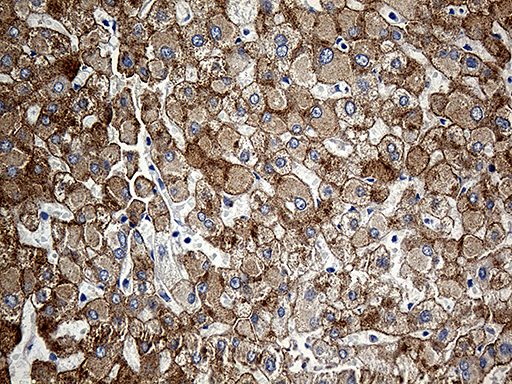 CLEC10A / CD301 Antibody - Immunohistochemical staining of paraffin-embedded Human liver tissue within the normal limits using anti-CLEC10A mouse monoclonal antibody. (Heat-induced epitope retrieval by 1mM EDTA in 10mM Tris buffer. (pH8.5) at 120°C for 3 min. (1:500)