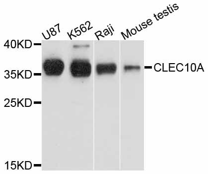 CLEC10A / CD301 Antibody - Western blot analysis of extracts of various cell lines, using CLEC10A antibody at 1:1000 dilution. The secondary antibody used was an HRP Goat Anti-Rabbit IgG (H+L) at 1:10000 dilution. Lysates were loaded 25ug per lane and 3% nonfat dry milk in TBST was used for blocking. An ECL Kit was used for detection and the exposure time was 90s.