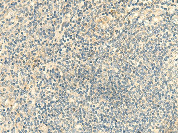 CLEC10A / CD301 Antibody - Immunohistochemistry of paraffin-embedded Human tonsil tissue  using CLEC10A Polyclonal Antibody at dilution of 1:50(×200)