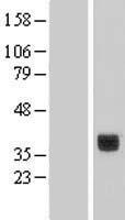 CLEC10A / CD301 Protein - Western validation with an anti-DDK antibody * L: Control HEK293 lysate R: Over-expression lysate