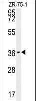 CLEC12A / CD371 Antibody - CLEC12A Antibody western blot of ZR-75-1 cell line lysates (35 ug/lane). The CLEC12A antibody detected the CLEC12A protein (arrow).
