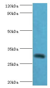 CLEC12A / CD371 Antibody - Western blot. All lanes: C-type lectin domain family 12 member A antibody at 2 ug/ml+mouse skeletal muscle tissue. Secondary antibody: Goat polyclonal to rabbit at 1:10000 dilution. Predicted band size: 31 kDa. Observed band size: 31 kDa.