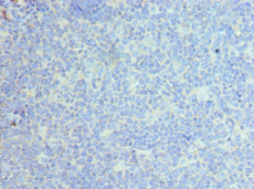 CLEC12A / CD371 Antibody - Immunohistochemistry of paraffin-embedded human tonsil tissue using CLEC12A Antibody at dilution of 1:100