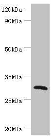 CLEC12A / CD371 Antibody - Western blot All lanes: C-type lectin domain family 12 member A antibody at 2µg/ml + Mouse skeletal muscle tissue Secondary Goat polyclonal to rabbit IgG at 1/10000 dilution Predicted band size: 31, 33, 9, 28, 25 kDa Observed band size: 31 kDa