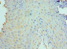CLEC12A / CD371 Antibody - Immunohistochemistry of paraffin-embedded human tonsil using antibody at 1:100 dilution.