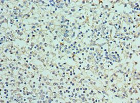 CLEC12A / CD371 Antibody - Immunohistochemistry of paraffin-embedded human spleen using antibody at 1:100 dilution.