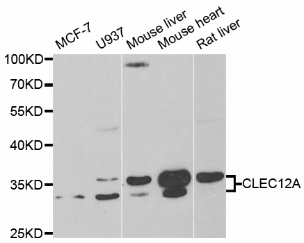 CLEC12A / CD371 Antibody - Western blot analysis of extracts of various cell lines, using CLEC12A antibody.