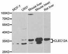 CLEC12A / CD371 Antibody - Western blot analysis of extracts of various cell lines, using CLEC12A antibody.