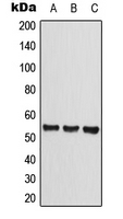 CLEC14A Antibody - Western blot analysis of CLEC14A expression in HEK293T (A); Raw264.7 (B); rat liver (C) whole cell lysates.