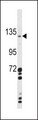 CLEC16A / KIAA0350 Antibody - Western blot of CLEC16A Antibody in A2058 cell line lysates (35 ug/lane). CLEC16A (arrow) was detected using the purified antibody.