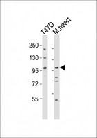 CLEC16A / KIAA0350 Antibody - All lanes : Anti-CLEC16A Antibody at 1:1000 dilution Lane 1: T47D whole cell lysates Lane 2: mouse heart lysates Lysates/proteins at 20 ug per lane. Secondary Goat Anti-Rabbit IgG, (H+L), Peroxidase conjugated at 1/10000 dilution Predicted band size : 118 kDa Blocking/Dilution buffer: 5% NFDM/TBST.