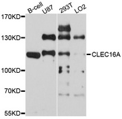 CLEC16A / KIAA0350 Antibody - Western blot analysis of extract of various cells.