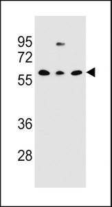 CLEC17A Antibody - CLEC17A Antibody western blot of NCI-H460,293,MDA-MB231 cell line lysates (35 ug/lane). The CLEC17A Antibody detected the CLEC17A protein (arrow).