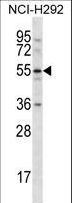CLEC18A Antibody - CLEC18A Antibody western blot of NCI-H292 cell line lysates (35 ug/lane). The CLEC18A antibody detected the CLEC18A protein (arrow).