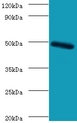 CLEC18A Antibody - Western blot of C-type lectin domain family 18 member A antibody at 2 ug/ml with mouse stomach tissue.  This image was taken for the unconjugated form of this product. Other forms have not been tested.